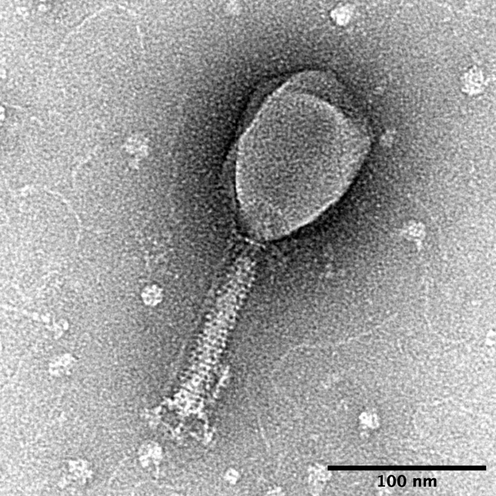 Transmission electron micrograph of Enterobacteria phage T2 virus particles